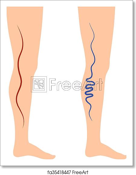 450x580 Free Art Print Of Vector Illustration Leg Veins Vector