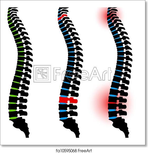 561x581 Free Art Print Of Vector Human Spine Silhouettes Freeart