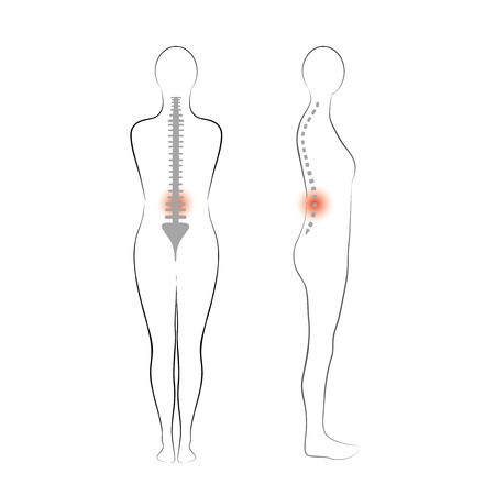 450x450 Vector Woman Body Shape, Vertebrae Pain Royalty Free Vector Graphics