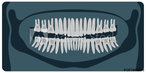 500x250 Panoramic Dental X Ray Healthy Tooth On X Ray Vector