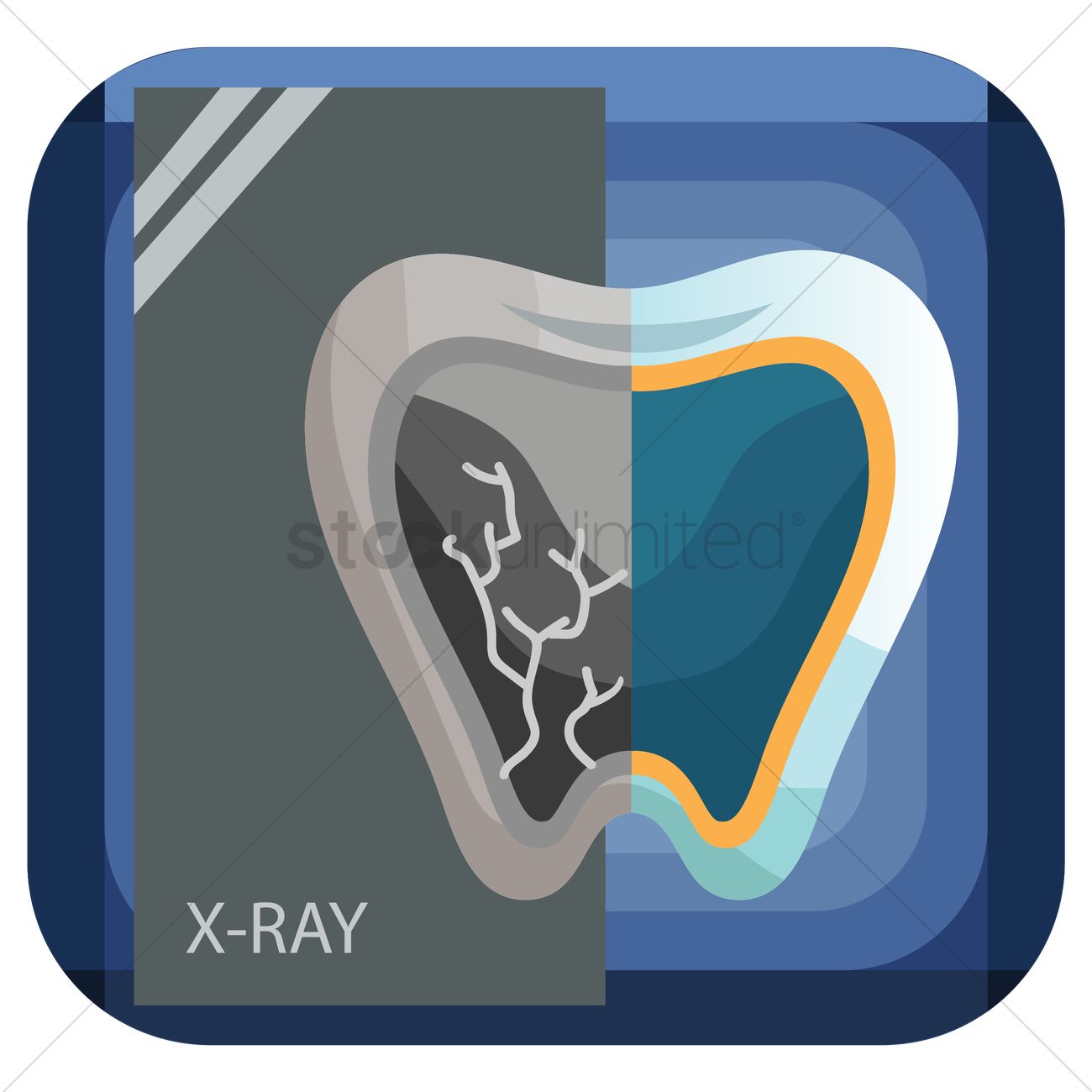 1300x1300 Tooth X Ray Vector Image