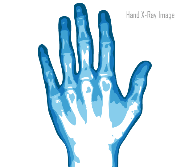 600x543 X Ray Hand Vector Image Download Free Vector Art Free Vectors