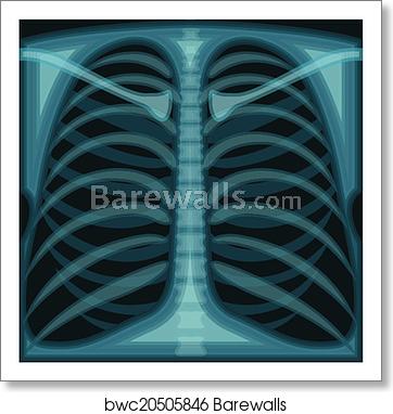 362x382 Chest X Ray, Art Print Barewalls Posters Prints