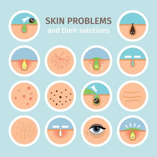 612x612 Why Do I Keep Getting Cystic Acne What Is The Best Foundation