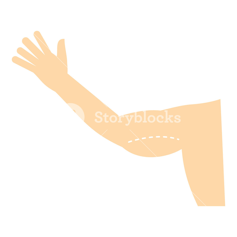 1000x1000 Plastic Surgery Of Arm Icon Flat Isolated On White Background