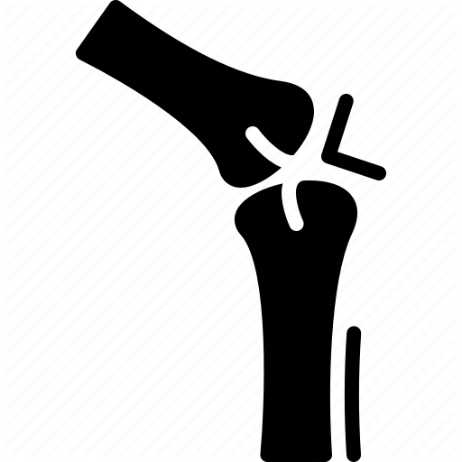 512x512 Arthralgia, Arthritis, Cartilage, Joint, Medical, Osteoarthritis