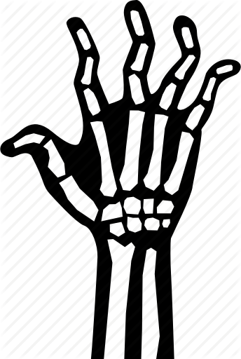 344x512 Arthritis, Bone, Finger, Hand, Xray Icon