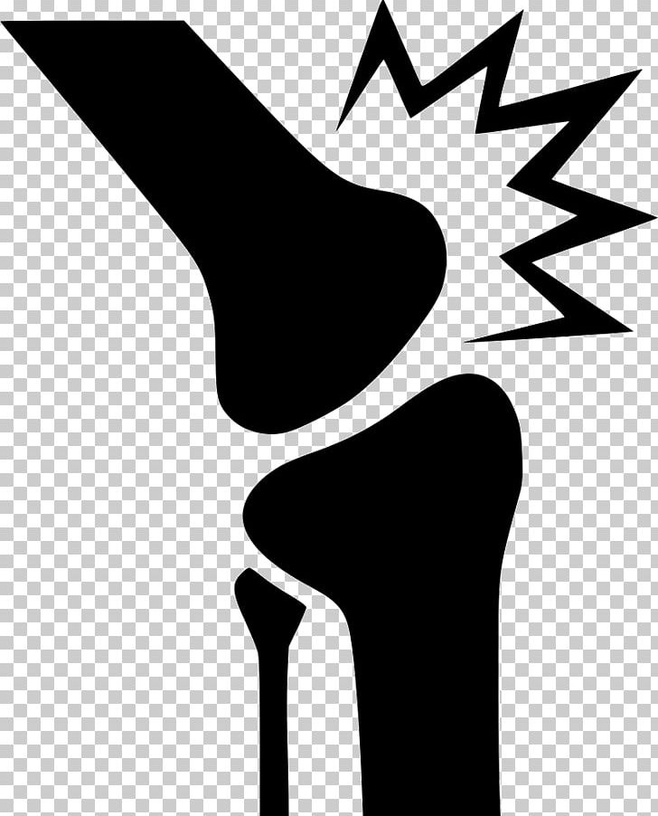 728x902 Knee Pain Back Pain Computer Icons Joint Pain Arthritis Pain Png