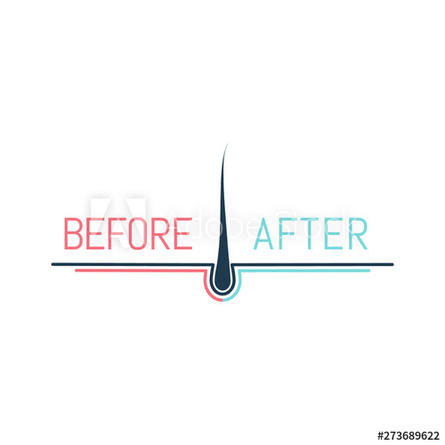 500x500 Hair Transplant Logo With A Follicle Icon For Medical Diagnostic