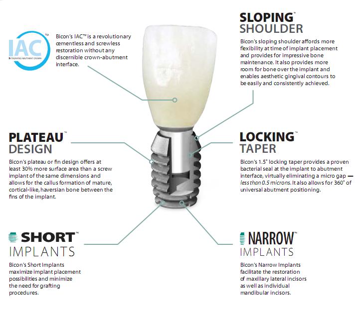 728x639 Bicon Dental Implants Rontis