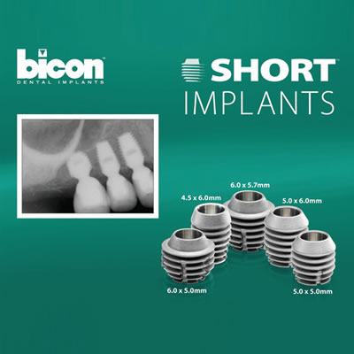400x400 Bicon Implant