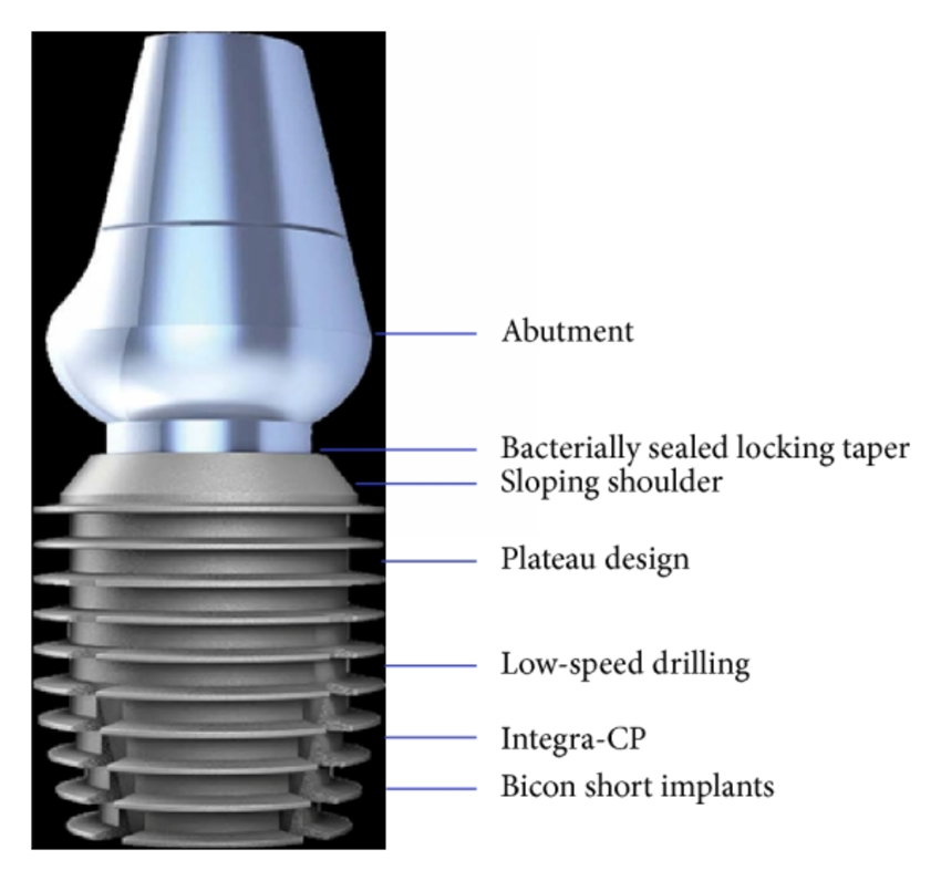 Dentium импланты отзывы. Bicon Dental Implants. Bicon импланты каталог. Байкон импланты винт для крепления. Имплантаты Байкон каталог.