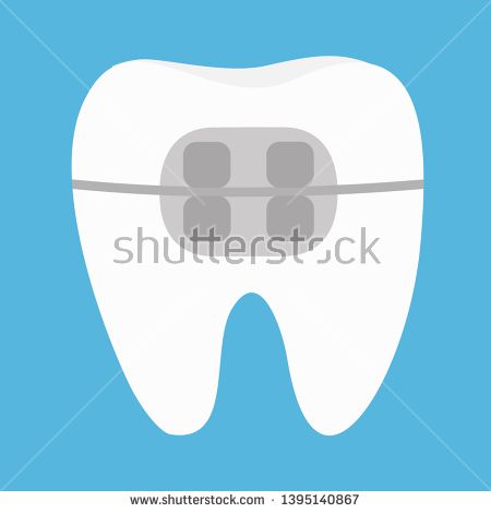 Stock Vector White Tooth Braces Icon Cute Cartoon Funny Icon 450x470 Stock Vector White Tooth Braces Icon Cute Cartoon Funny Icon