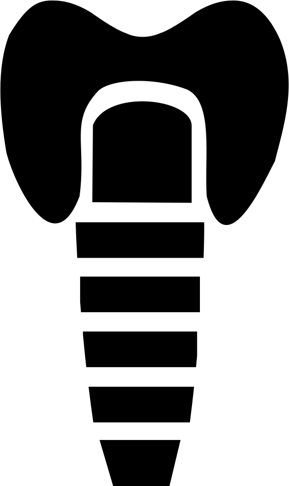 584x981 Dental Implant Png Icon Free Download