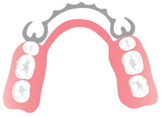 324x233 Dentures In Palm Harbor, Fl