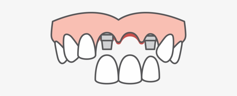 Denture Icon at Vectorified.com | Collection of Denture Icon free for ...