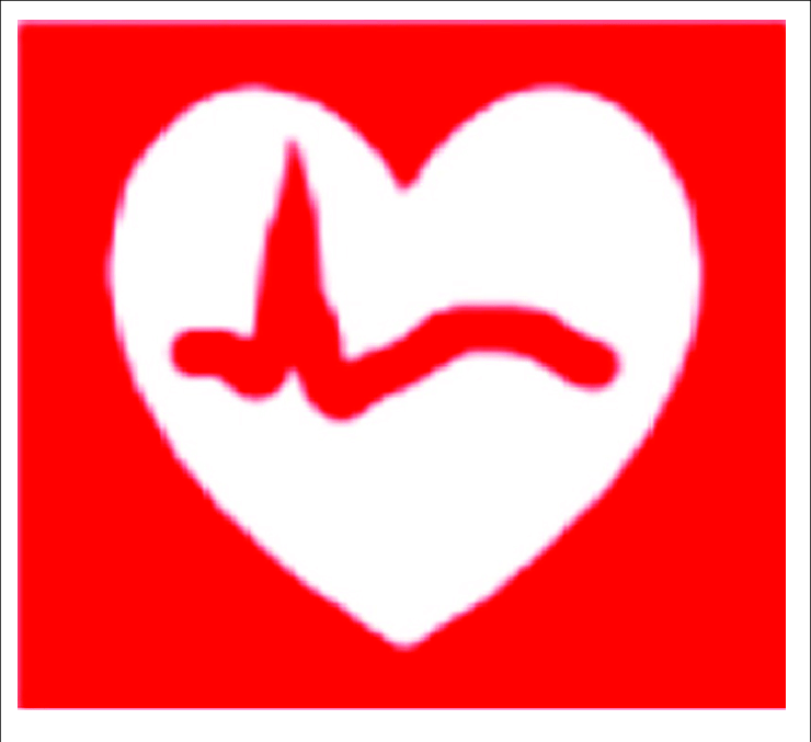 740x677 Example Of Vcm Icon To Describe A Cardiac Rhythm Disorder