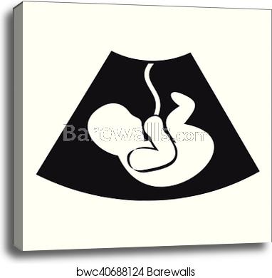 382x390 Ultrasound Fetus Icon, Simple Style, Canvas Print Barewalls