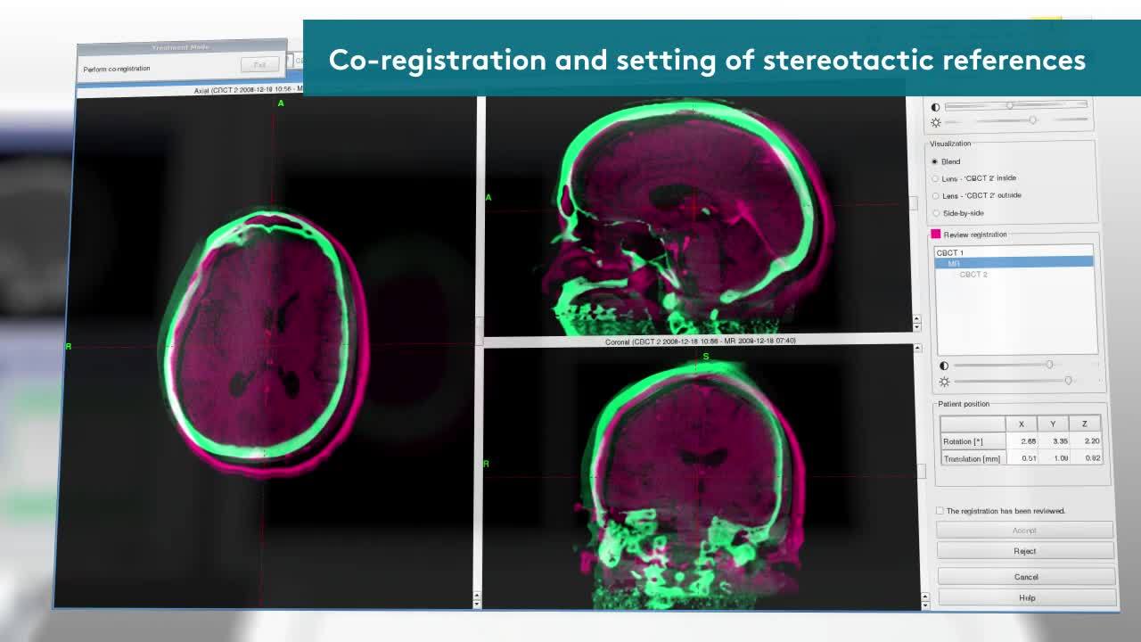1280x720 Leksell Gamma