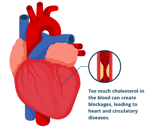580x500 What Is High Cholesterol Heart Uk The Cholesterol Charity