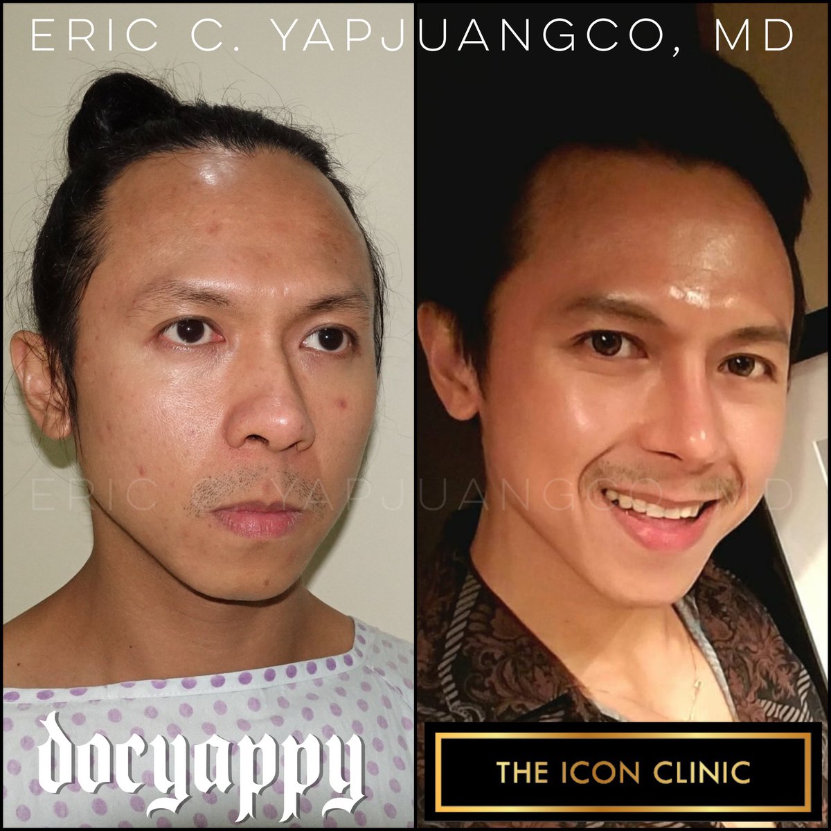 Eric Yapjuangco, Md On Twitter 1200x1200 Eric Yapjuangco, Md On Twitter