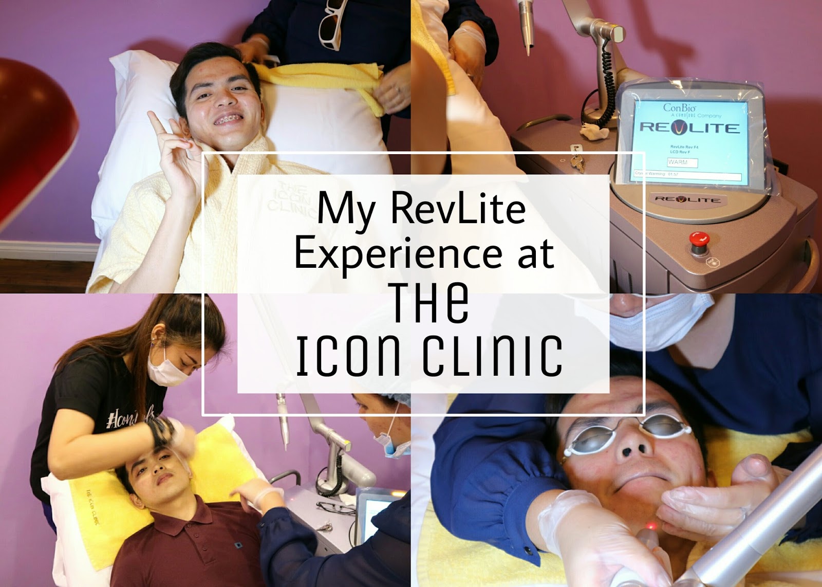 My Revlite Laser Experience 1600x1142 My Revlite Laser Experience