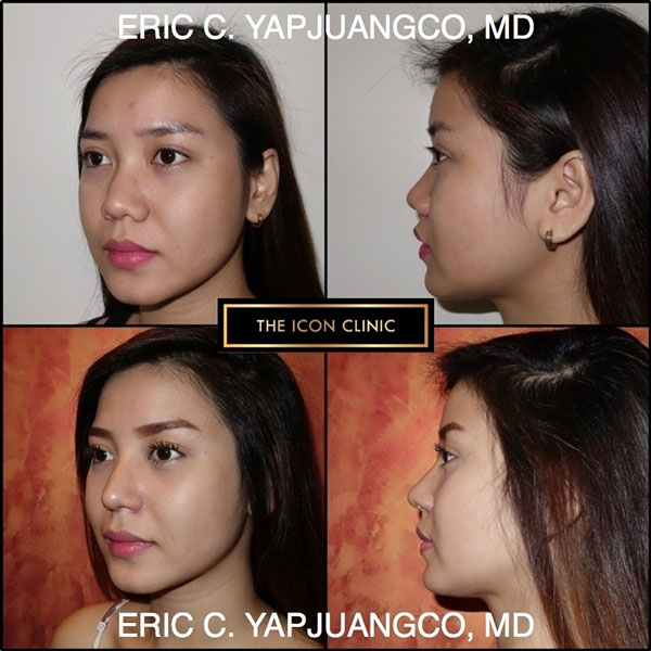 Face The Icon Clinic 600x600 Face The Icon Clinic