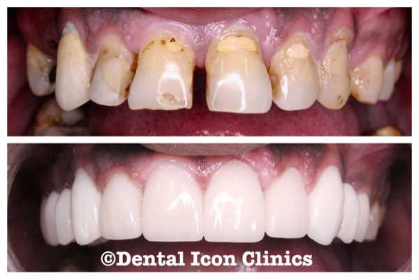 Center Dental Icon Clinics Dentist 600x401 Center Dental Icon Clinics Dentist