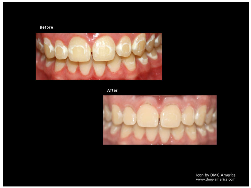 817x611 Dmg Icon Dental Supplier South Africa