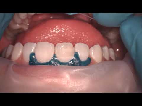 480x360 Using The New Product Icon