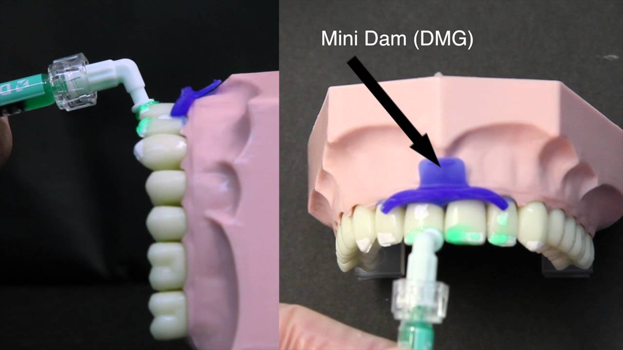 1280x720 Icon Treatment Tutorial