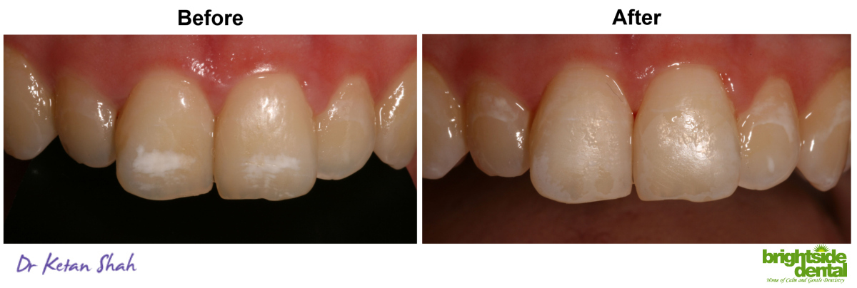 Icon Dentist In Bounds Green 1200x404 Icon Dentist In Bounds Green