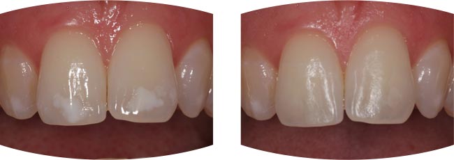 650x230 White Spots With Icon Faces And Smiles