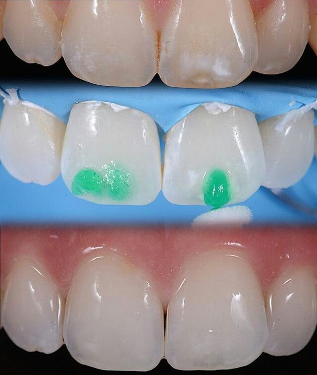 640x756 Dental Services