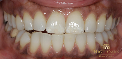 400x193 High Oaks Dental Practice