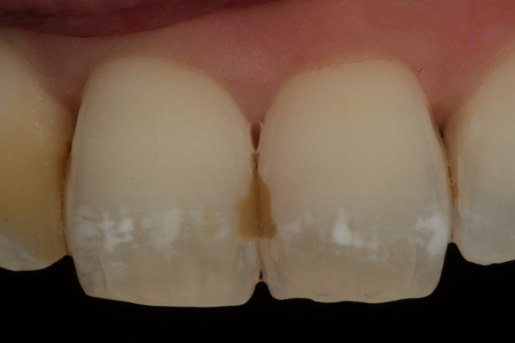 1024x683 Fluorosis And Icon Dmg Cases And Scientific Evidence