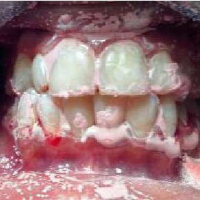 290x290 The Icon Kit