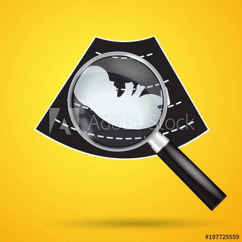 500x500 Ultrasonography Baby Icon Screening Baby