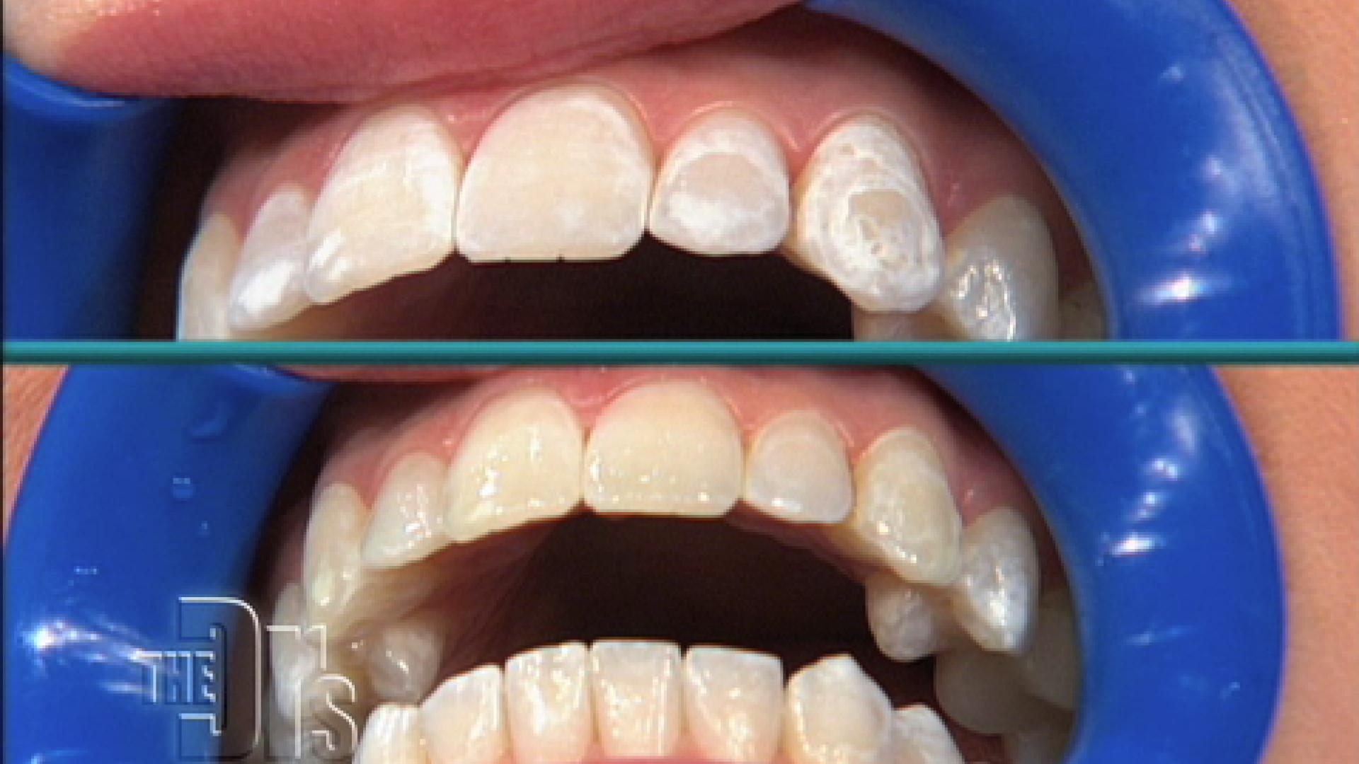 1920x1080 Icon Treatment The Doctors Tv Show