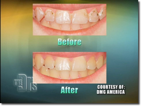 A Plea To Use Dmg Icon Infiltrant 498x372 A Plea To Use Dmg Icon Infiltrant