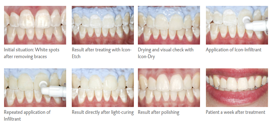 879x430 White Spots With Icon Faces And Smiles