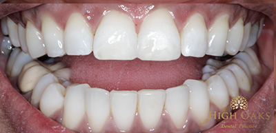 400x193 High Oaks Dental Practice