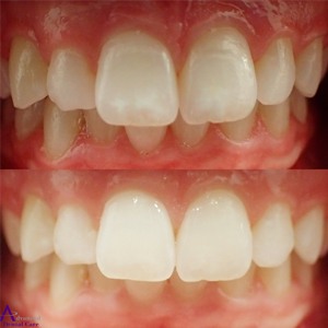 300x300 Icon Treatment Cosmetic Dentistry Costa Mesa Dentist