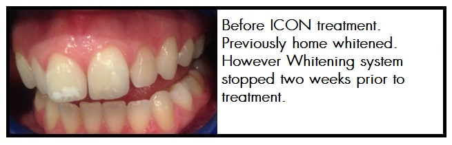 655x211 Icon Treatment Ashford Dental