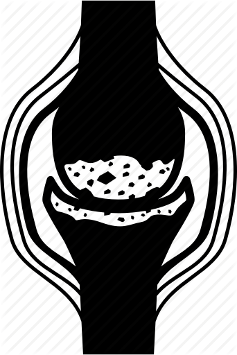 342x512 Arthritis, Bone, Joint, Osteoarthritis, Pan