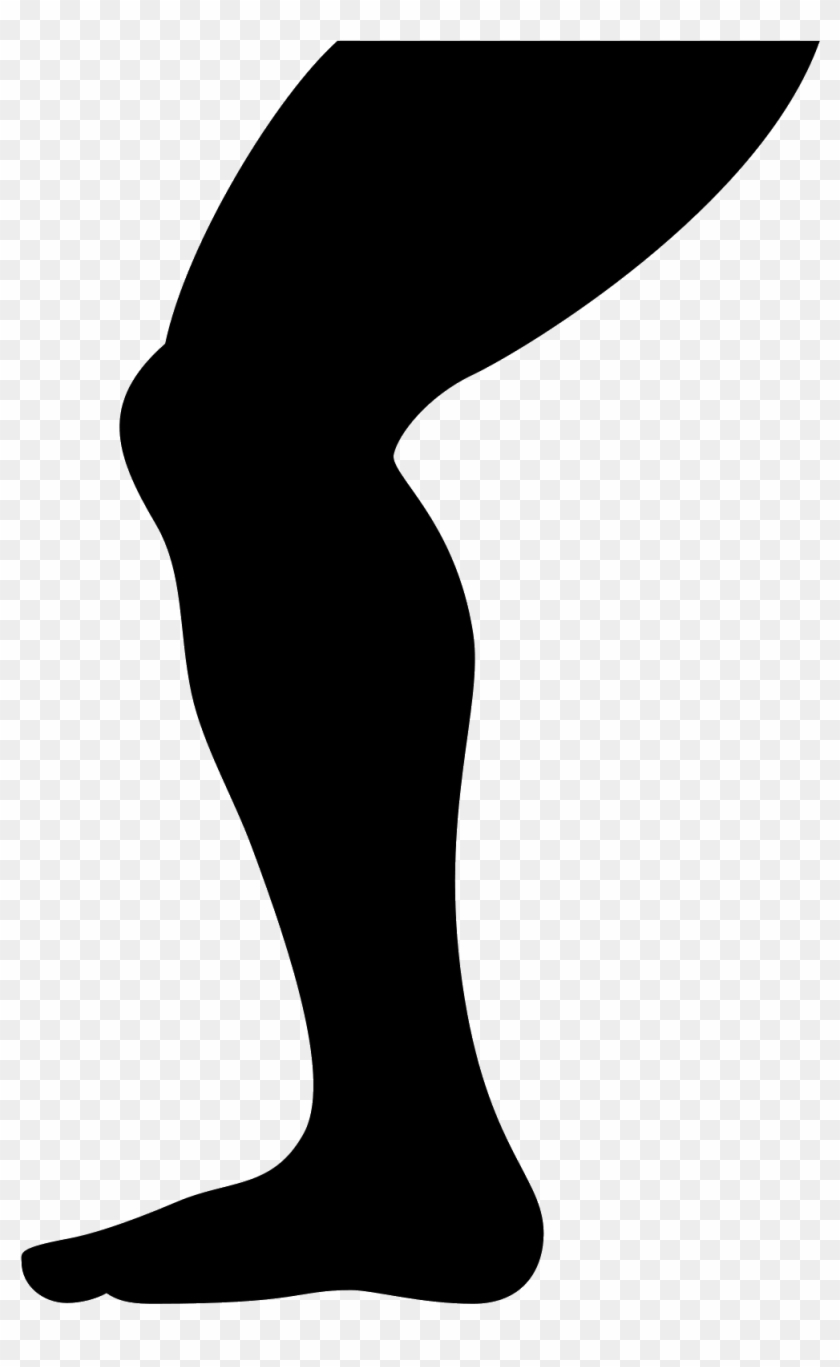 840x1367 This Is A Leg From The Top Of The Thigh Down