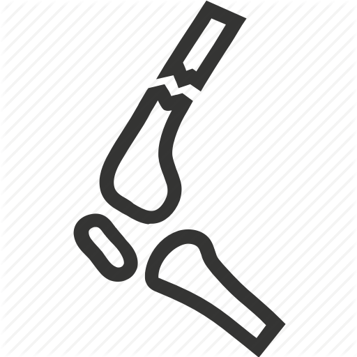 512x512 Bone, Break, Broken Leg, Fracture, Injury, Leg Icon