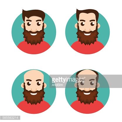 416x416 Stages Of Hair Loss Icon Premium Clipart