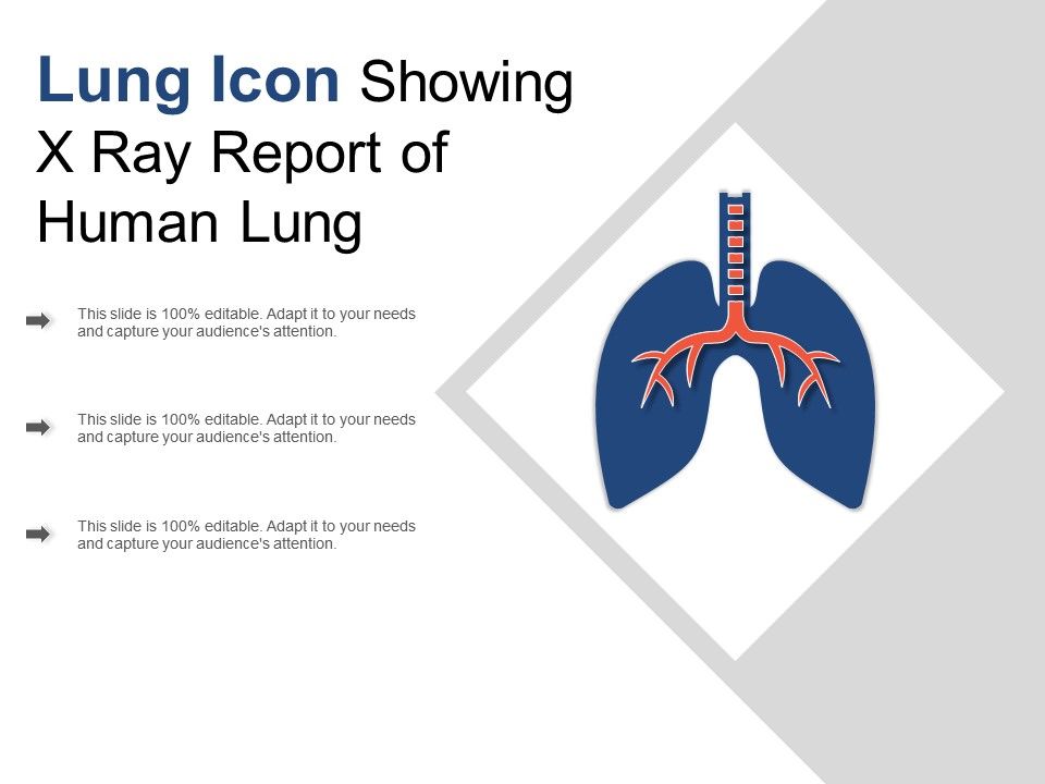 960x720 Lung Icon Showing X Ray Report Of Human Lung Powerpoint Slide