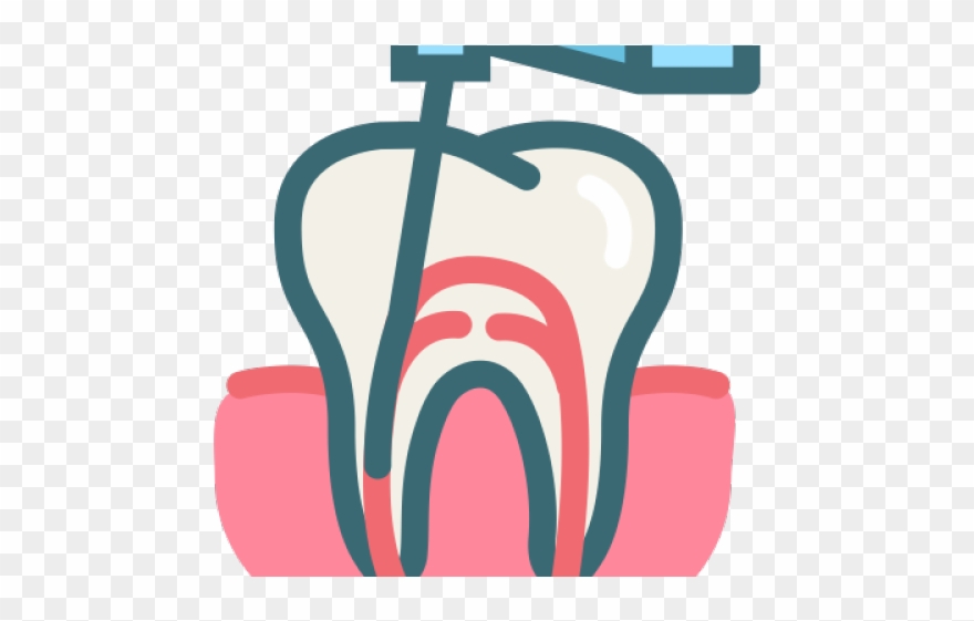 880x561 Teeth Clipart Root Canal